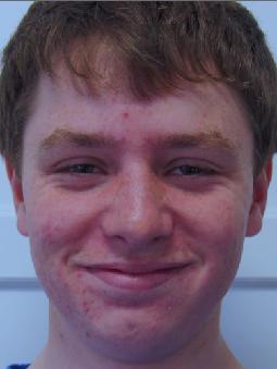 Ben RAKE