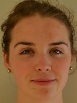 Aine WHITE