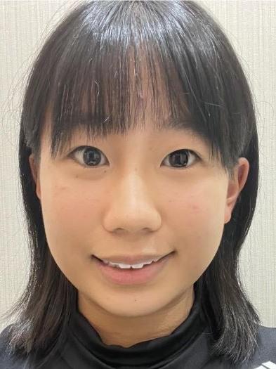 Haruna KOBAYASHI